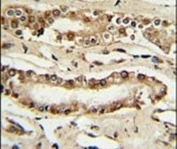 FOXP1 Antibody in Immunohistochemistry (IHC)