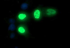 FOXP1 Antibody in Immunocytochemistry (ICC/IF)