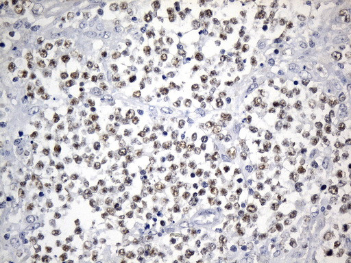 FOXP1 Antibody in Immunohistochemistry (Paraffin) (IHC (P))