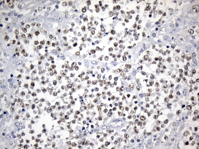FOXP1 Antibody in Immunohistochemistry (Paraffin) (IHC (P))