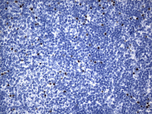 FOXP3 Antibody in Immunohistochemistry (Paraffin) (IHC (P))