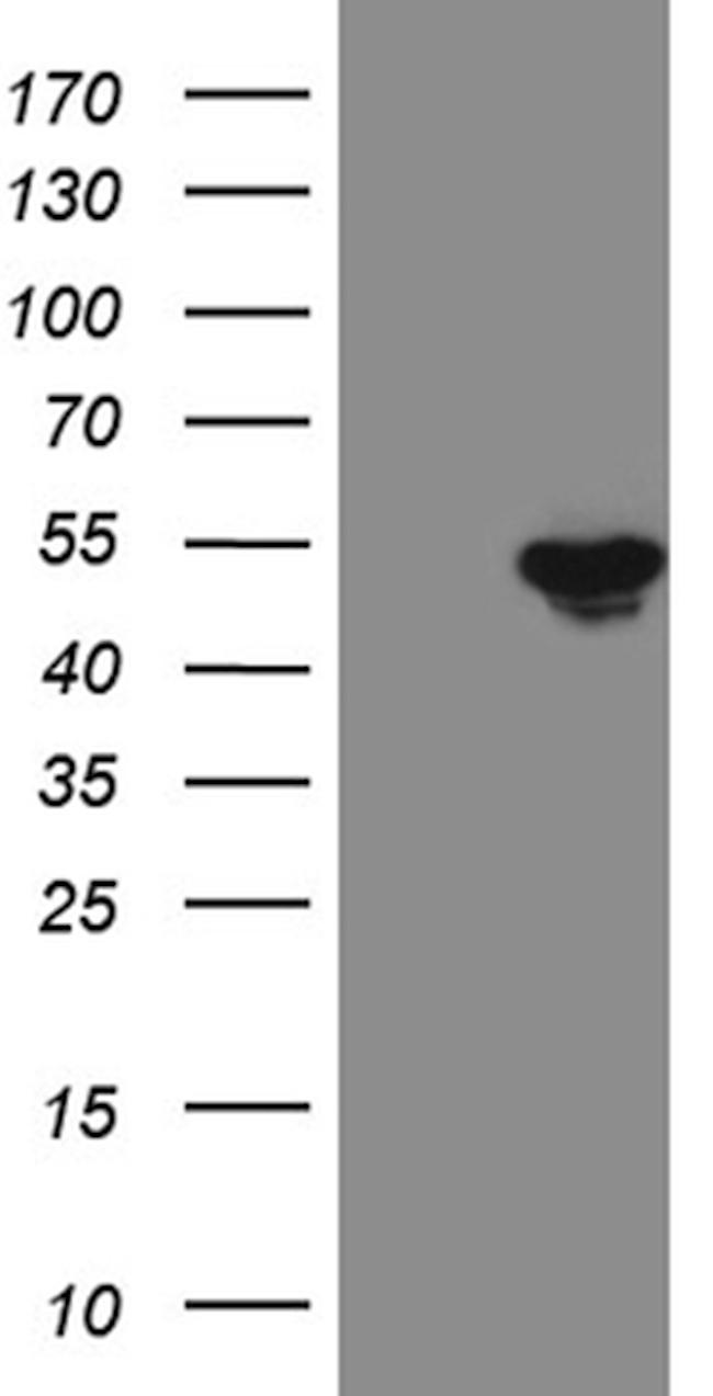 FOXP3 Antibody in Western Blot (WB)