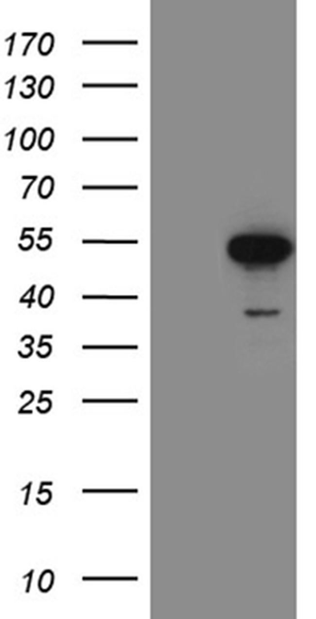 FOXP3 Antibody in Western Blot (WB)