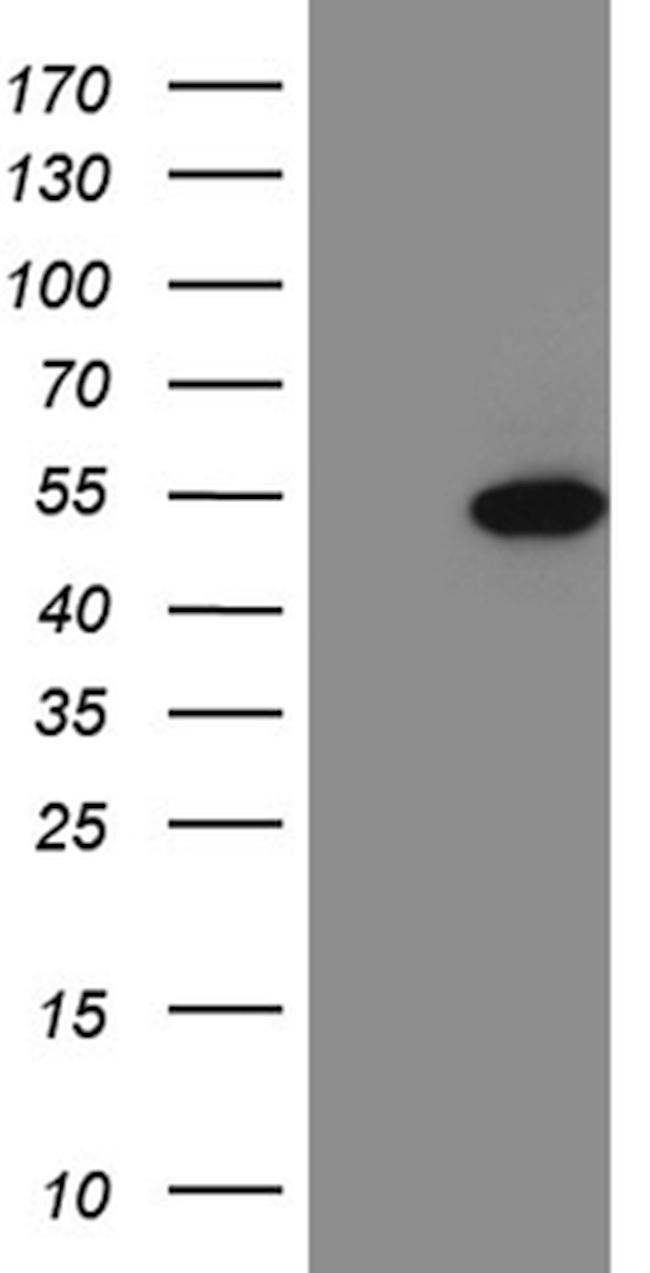 FOXP3 Antibody in Western Blot (WB)