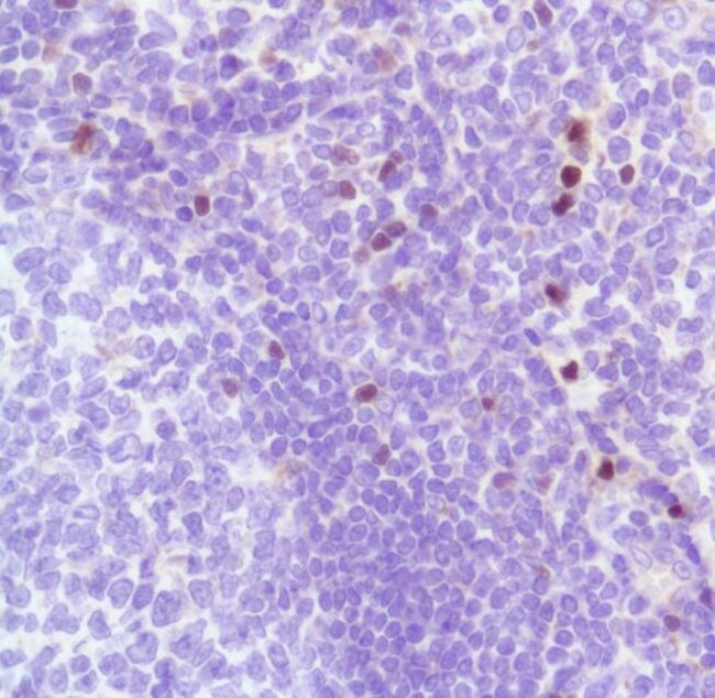 FOXP3 Antibody in Immunohistochemistry (Paraffin) (IHC (P))