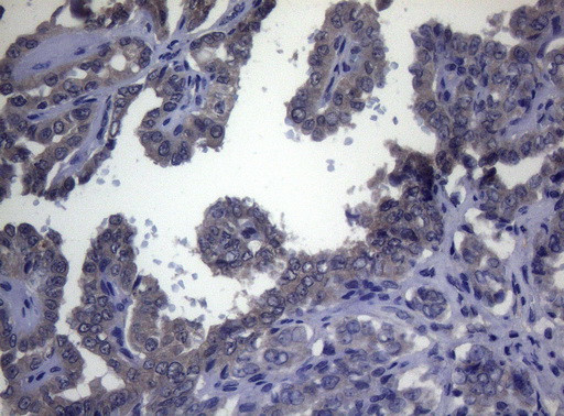 FOXQ1 Antibody in Immunohistochemistry (Paraffin) (IHC (P))