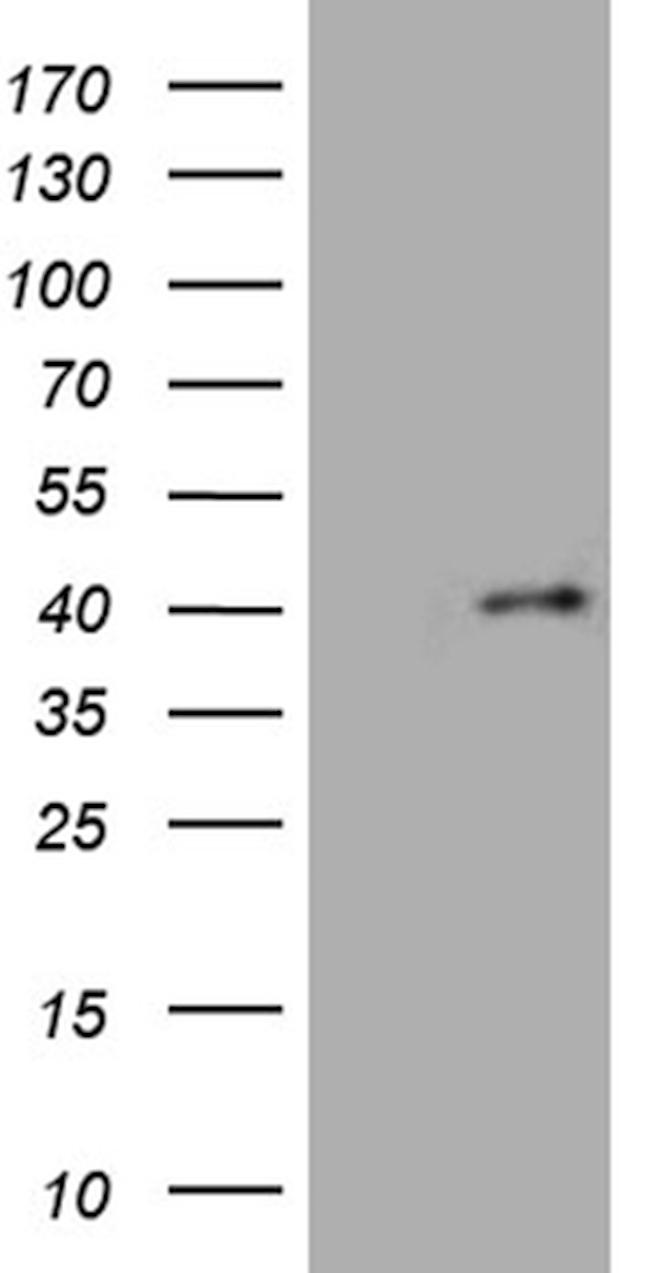 FOXR1 Antibody in Western Blot (WB)