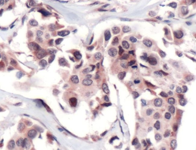 FPGS Antibody in Immunohistochemistry (IHC)