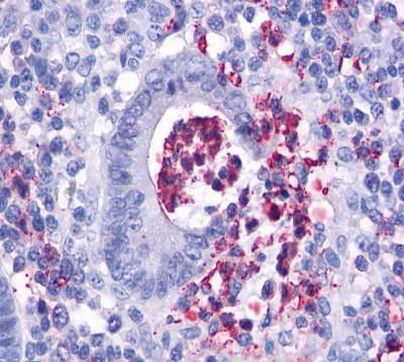 FPR2 Antibody in Immunohistochemistry (Paraffin) (IHC (P))