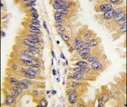 FRAT1 Antibody in Immunohistochemistry (IHC)