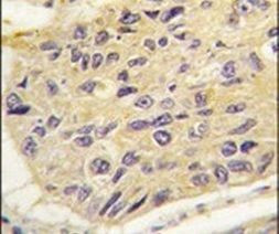 FRAT1 Antibody in Immunohistochemistry (IHC)