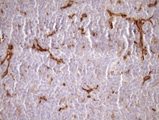 FSCN1 Antibody in Immunohistochemistry (Paraffin) (IHC (P))