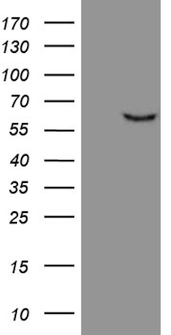 FSCN1 Antibody in Western Blot (WB)