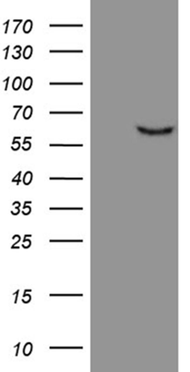 FSCN1 Antibody in Western Blot (WB)