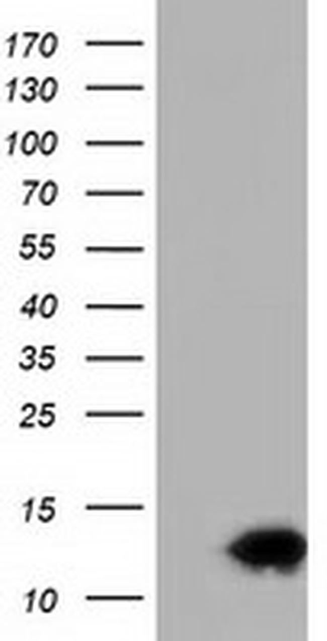 FSHB Antibody in Western Blot (WB)