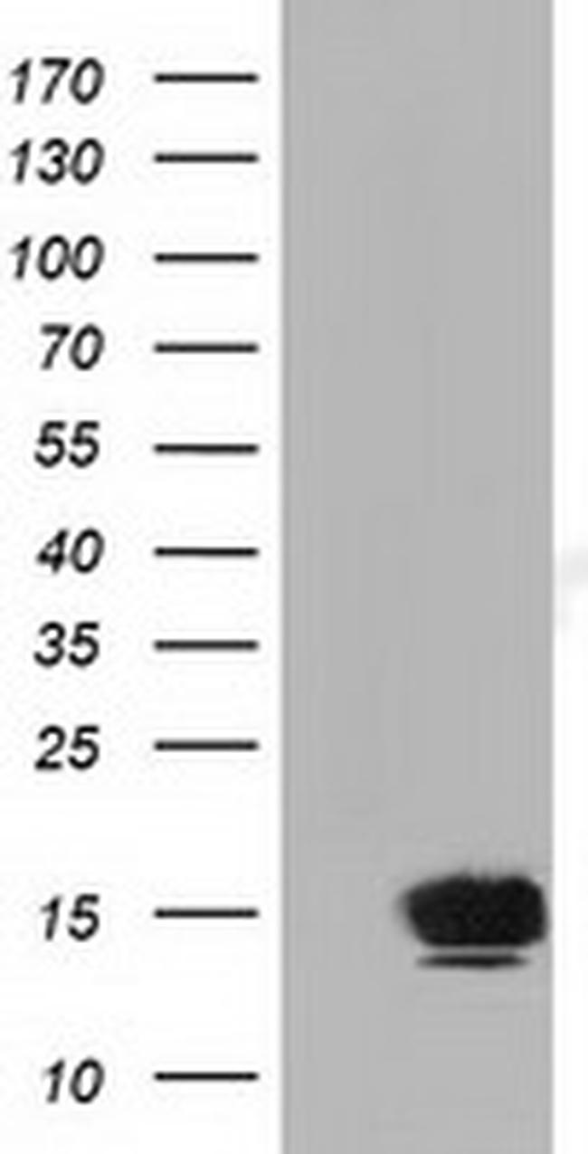 FSHB Antibody in Western Blot (WB)