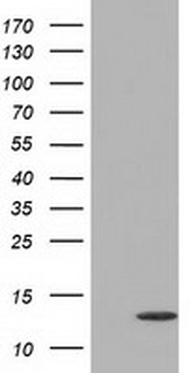 FSHB Antibody in Western Blot (WB)