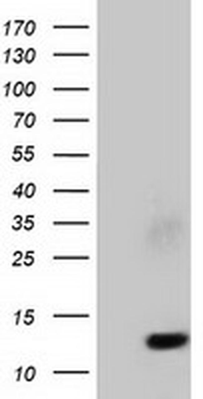 FSHB Antibody in Western Blot (WB)