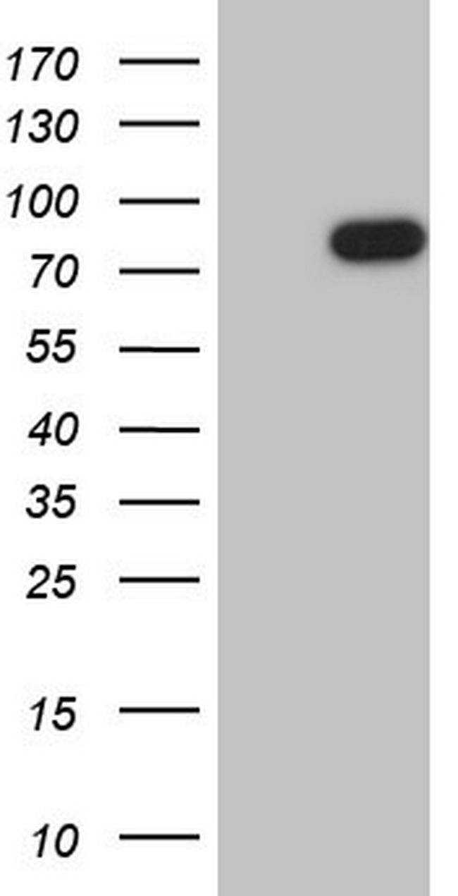 FSIP1 Antibody in Western Blot (WB)