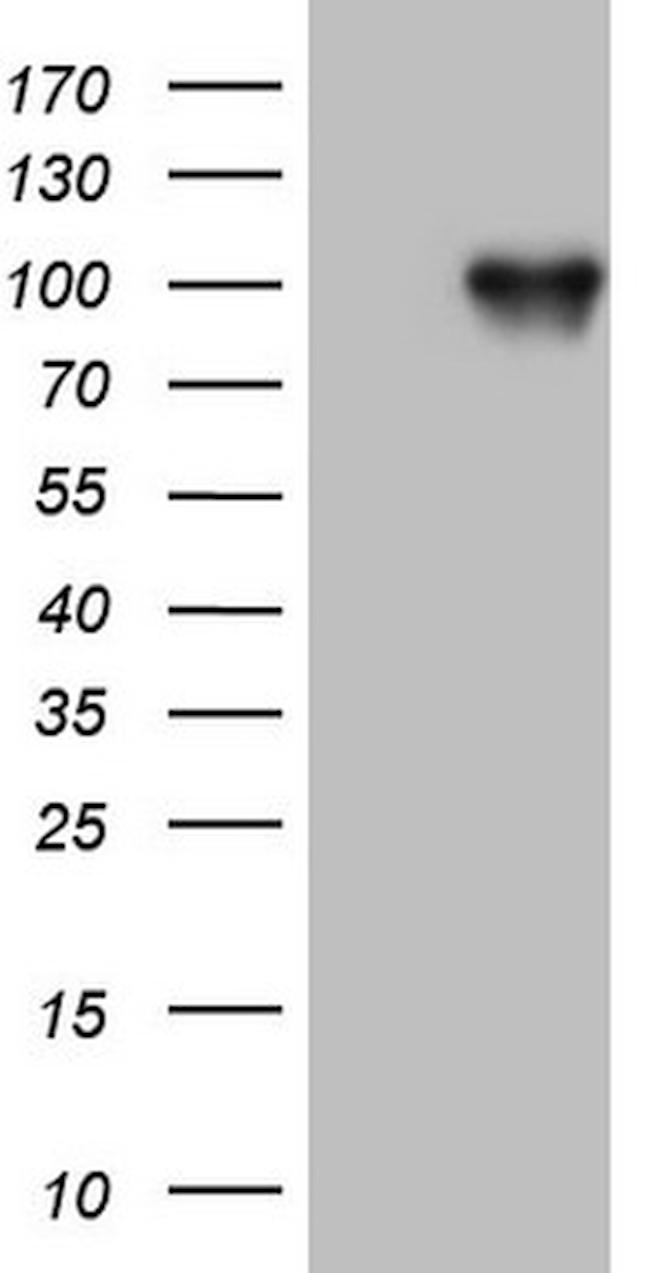 FSIP1 Antibody in Western Blot (WB)