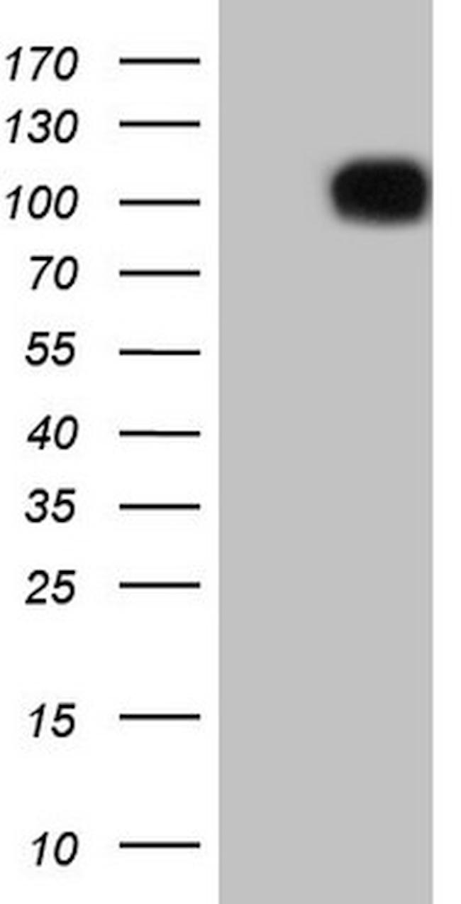 FSIP1 Antibody in Western Blot (WB)