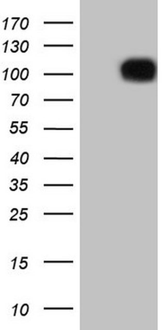 FSIP1 Antibody in Western Blot (WB)