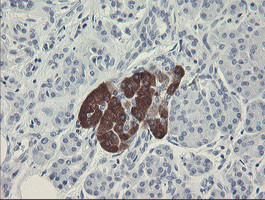 FTCD Antibody in Immunohistochemistry (Paraffin) (IHC (P))
