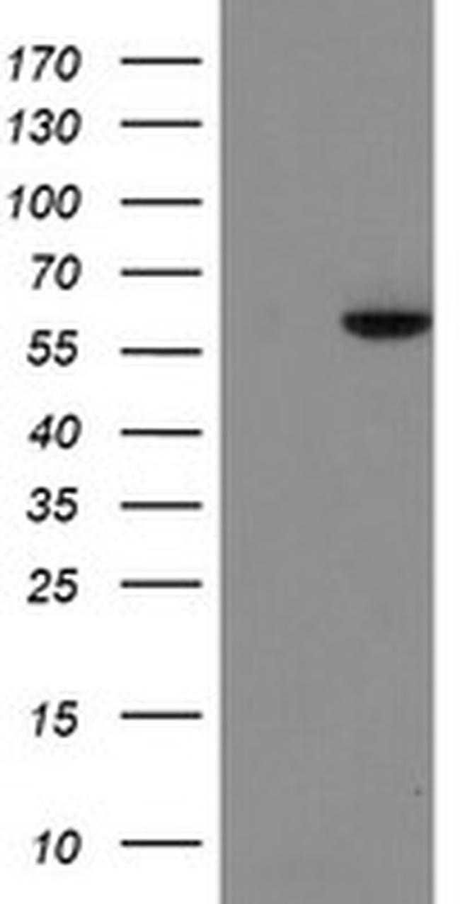 FTCD Antibody in Western Blot (WB)