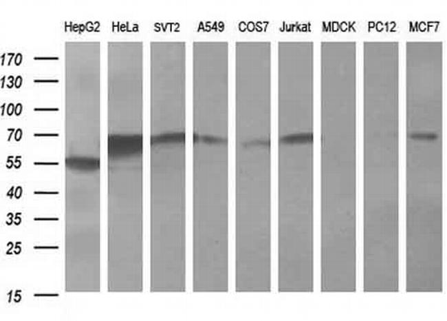 FTCD Antibody in Western Blot (WB)