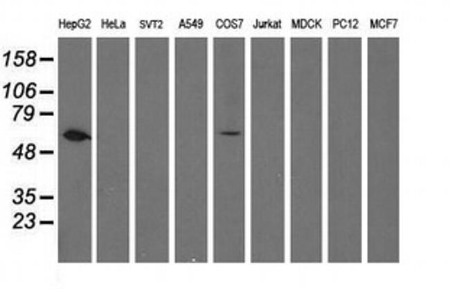 FTCD Antibody in Western Blot (WB)