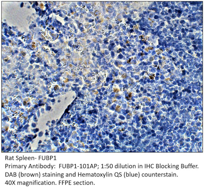 FUBP1 Antibody in Immunohistochemistry (IHC)