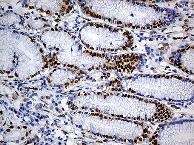 FUBP3 Antibody in Immunohistochemistry (Paraffin) (IHC (P))