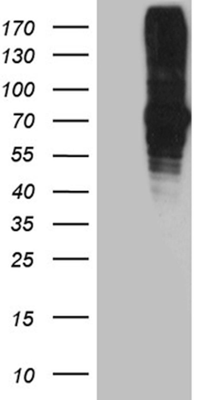 FUBP3 Antibody in Western Blot (WB)