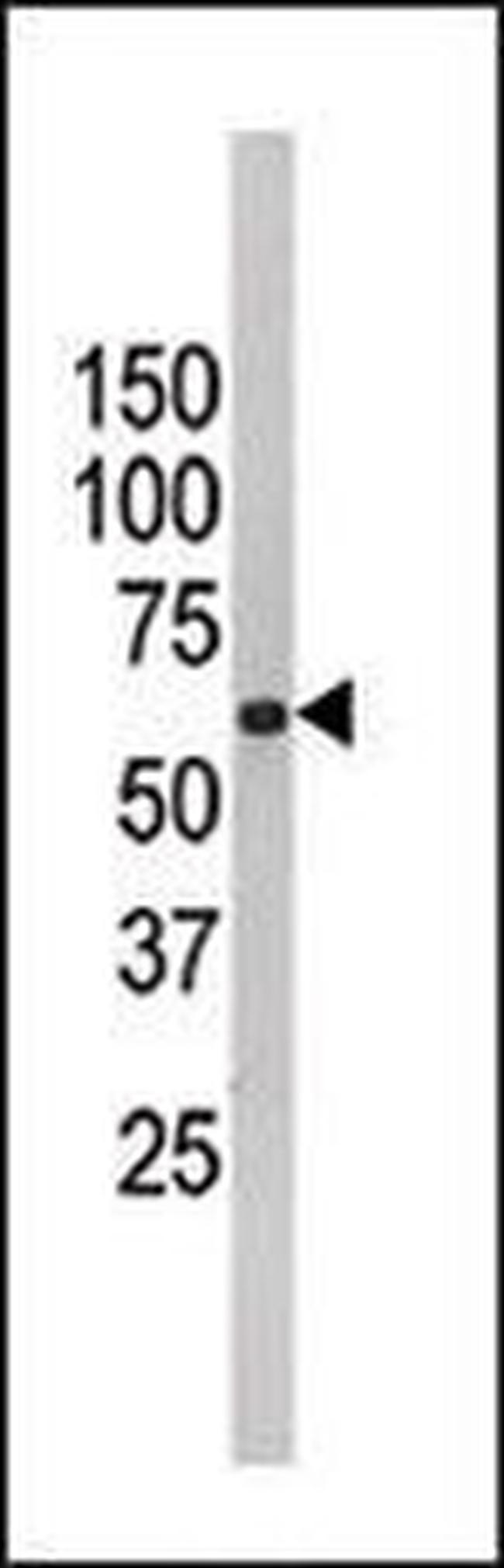 FUBP3 Antibody in Western Blot (WB)