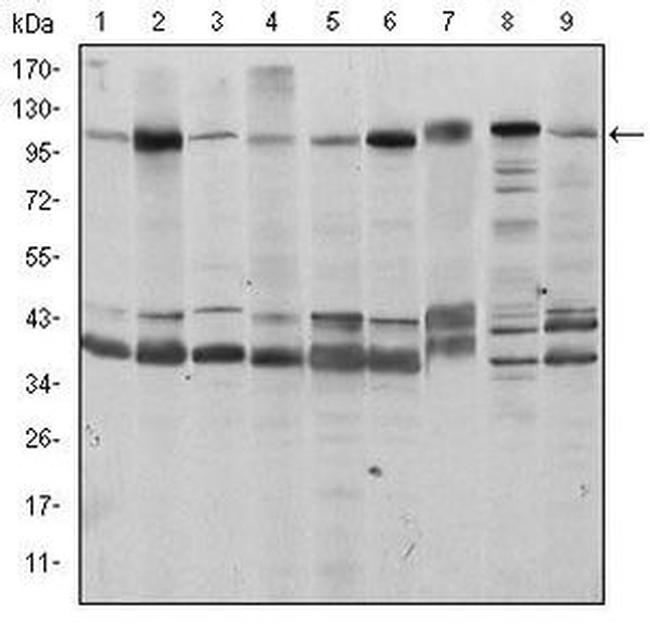 FUK Antibody in Western Blot (WB)