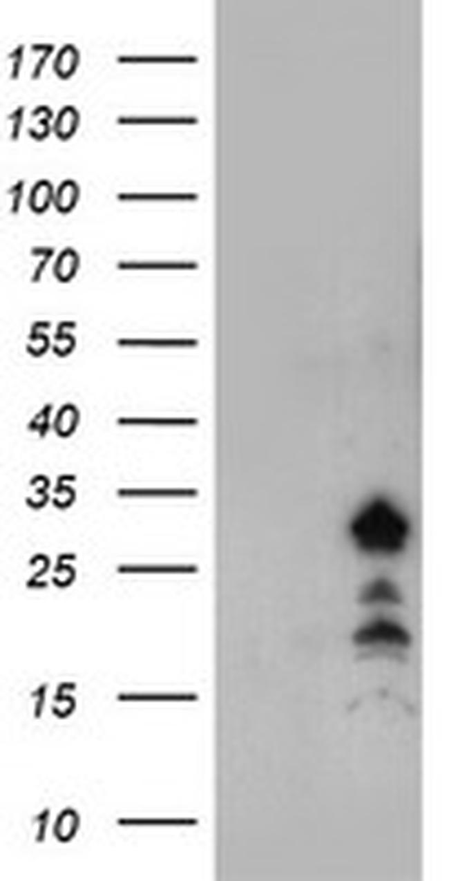 FXN Antibody in Western Blot (WB)