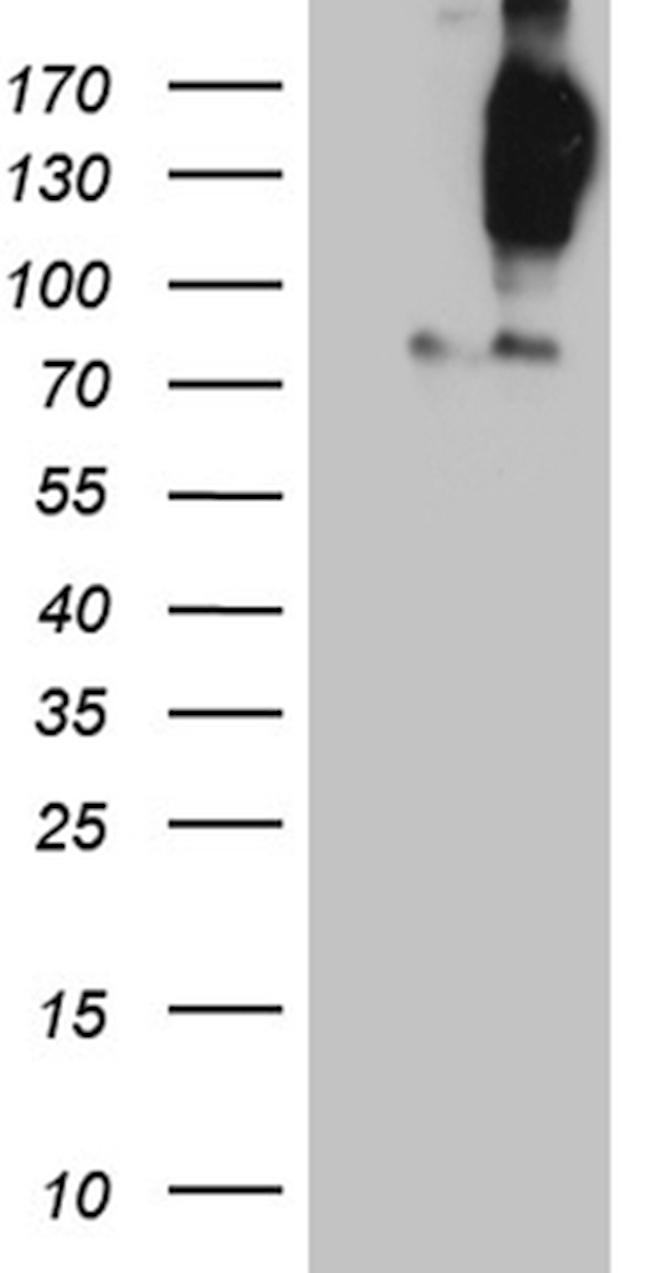 FYCO1 Antibody in Western Blot (WB)