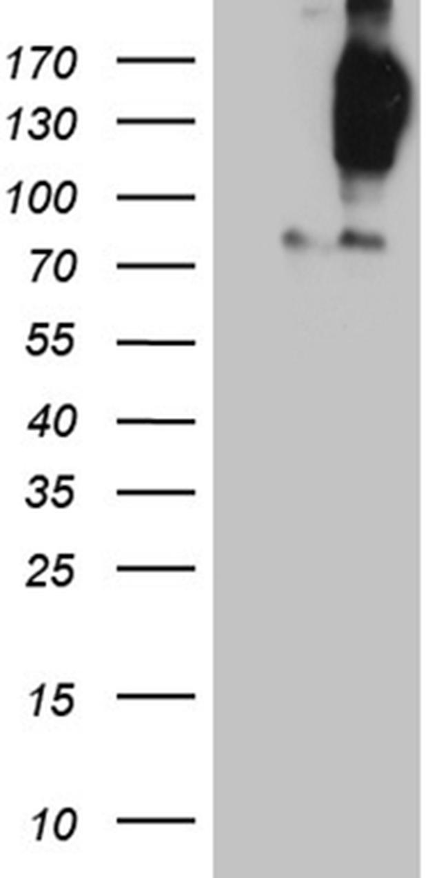 FYCO1 Antibody in Western Blot (WB)