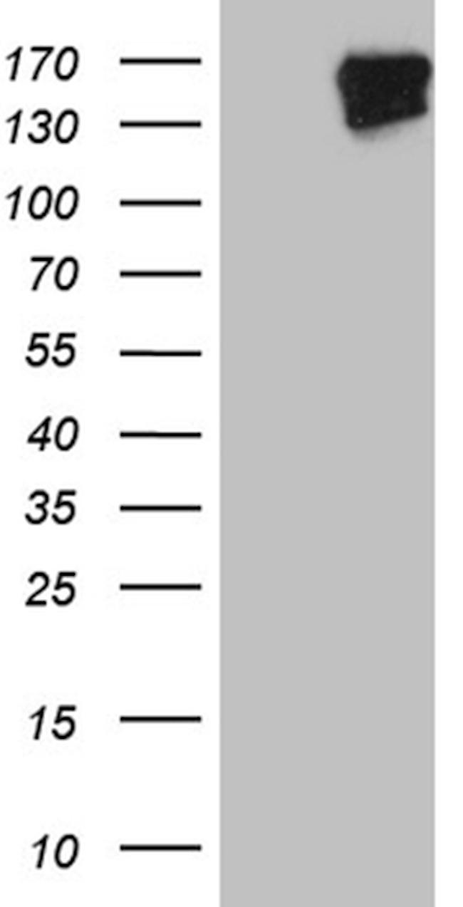FYCO1 Antibody in Western Blot (WB)