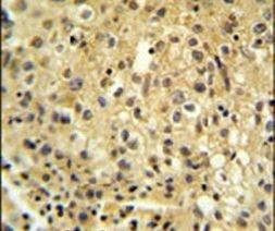 FYTTD1 Antibody in Immunohistochemistry (IHC)