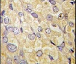 FZD1 Antibody in Immunohistochemistry (IHC)