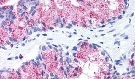 FZD1 Antibody in Immunohistochemistry (Paraffin) (IHC (P))