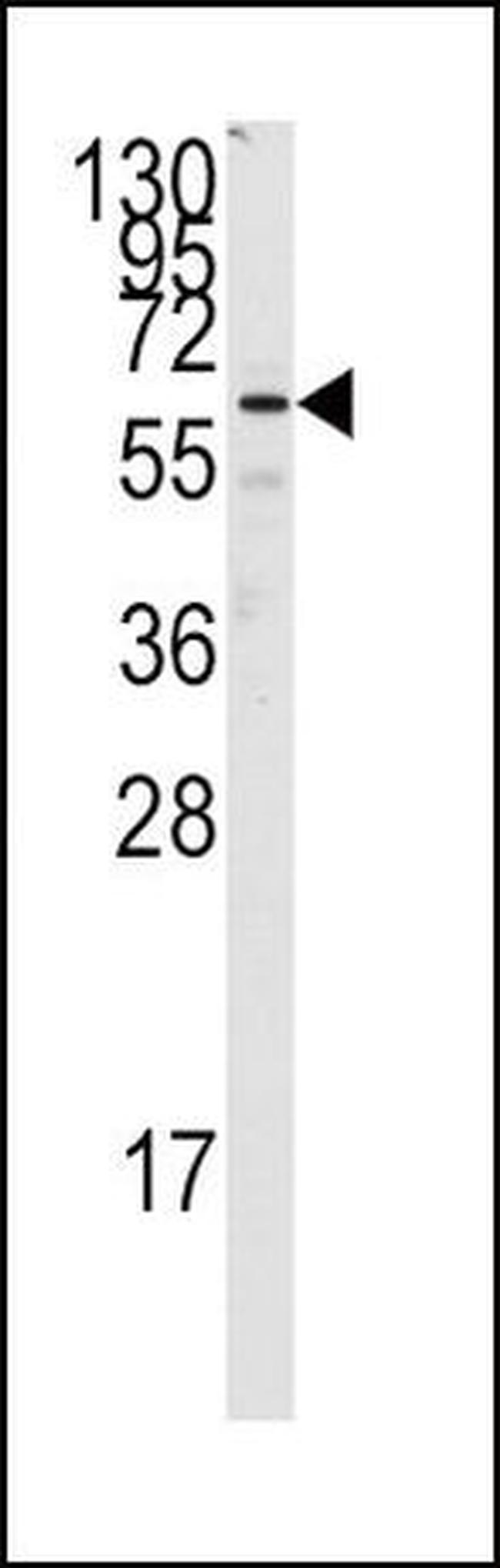 FZD1 Antibody in Western Blot (WB)