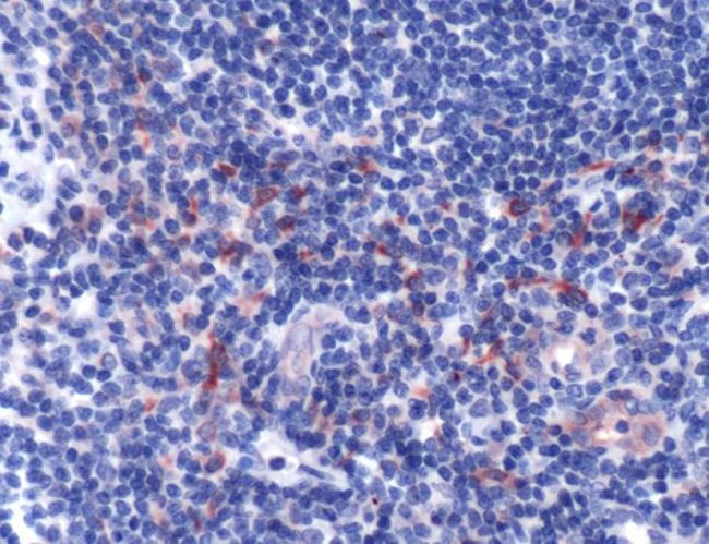 CD178 Antibody in Immunohistochemistry (IHC)