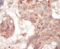 FLT3 Antibody in Immunohistochemistry (IHC)