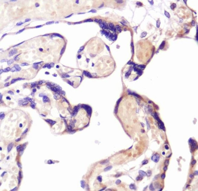 CD266 Antibody in Immunohistochemistry (IHC)