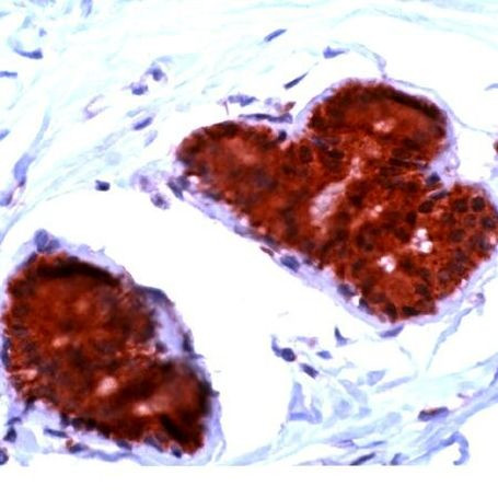 FHIT Antibody in Immunohistochemistry (IHC)