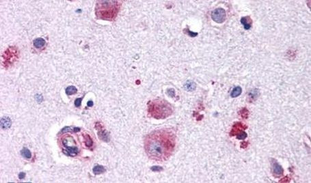 FZD9 Antibody in Immunohistochemistry (Paraffin) (IHC (P))
