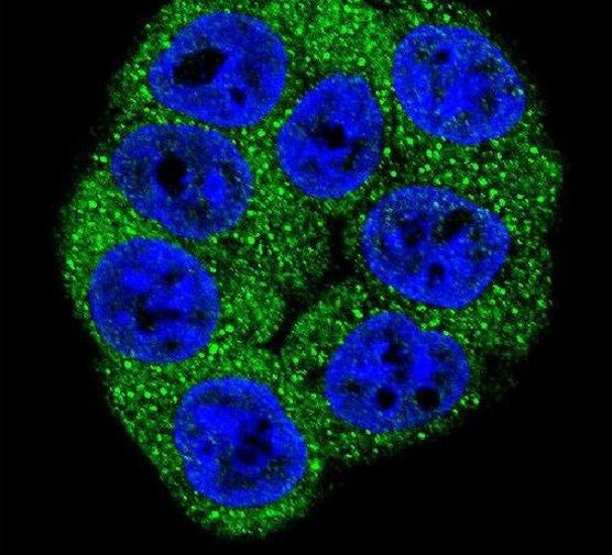 PFKM Antibody in Immunocytochemistry (ICC/IF)