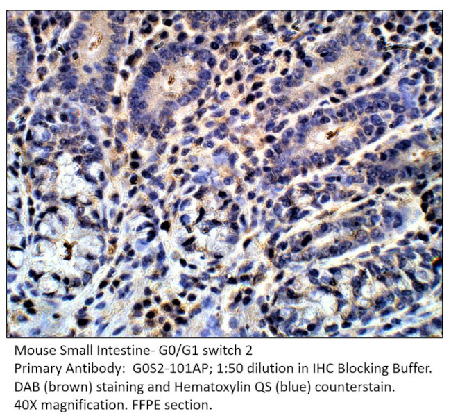 G0/G1 switch 2 Antibody in Immunohistochemistry (IHC)